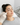 Dermatologist use a tiny loop extraction tool on a woman's blackheads in a sterile clinic